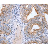 Immunohistochemistry - CLDN3 Antibody from Signalway Antibody (36889) - Antibodies.com