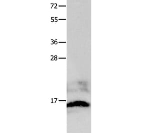 KISS1 Antibody from Signalway Antibody (36939) - Antibodies.com