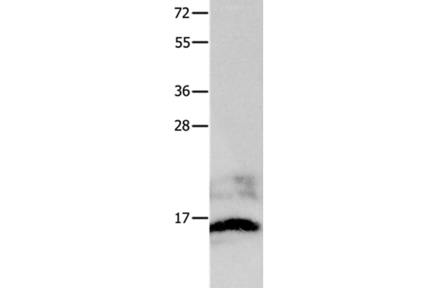 KISS1 Antibody from Signalway Antibody (36939) - Antibodies.com