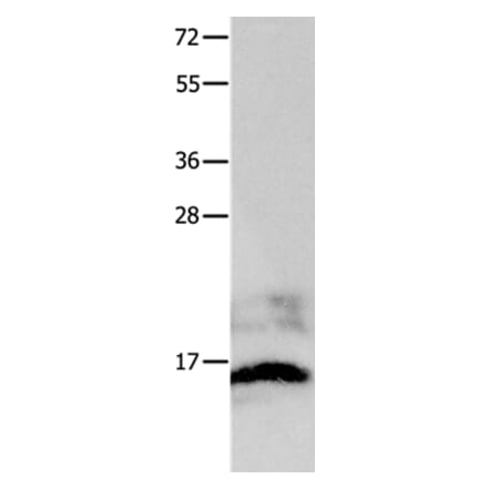 KISS1 Antibody from Signalway Antibody (36939) - Antibodies.com