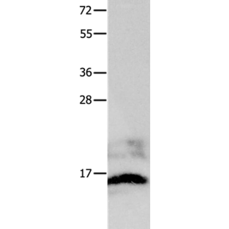 KISS1 Antibody from Signalway Antibody (36939) - Antibodies.com