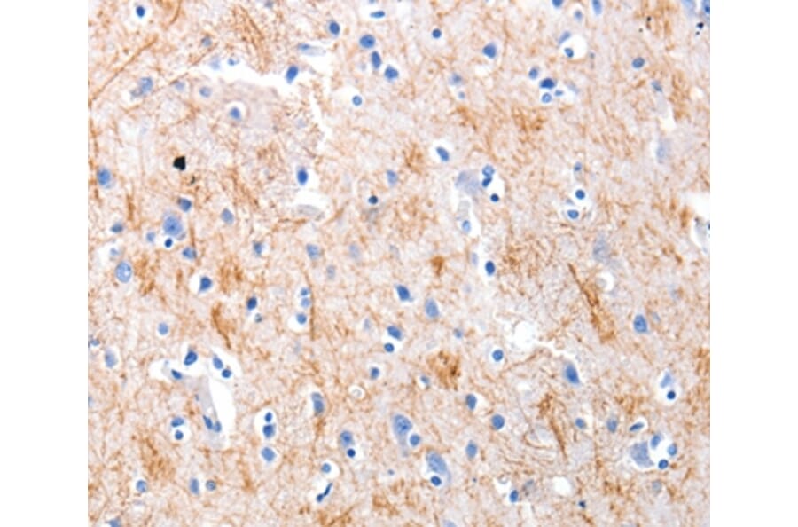 Immunohistochemistry - KISS1 Antibody from Signalway Antibody (36939) - Antibodies.com