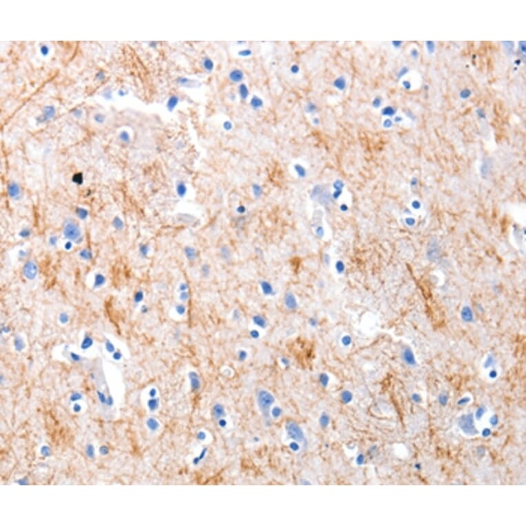 Immunohistochemistry - KISS1 Antibody from Signalway Antibody (36939) - Antibodies.com