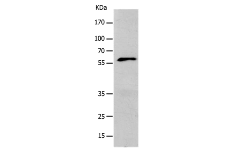 KCNC1 Antibody from Signalway Antibody (36944) - Antibodies.com