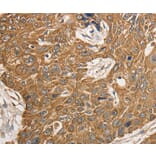 Immunohistochemistry - KCNC1 Antibody from Signalway Antibody (36944) - Antibodies.com