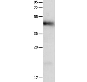 LRP1 Antibody from Signalway Antibody (36956) - Antibodies.com