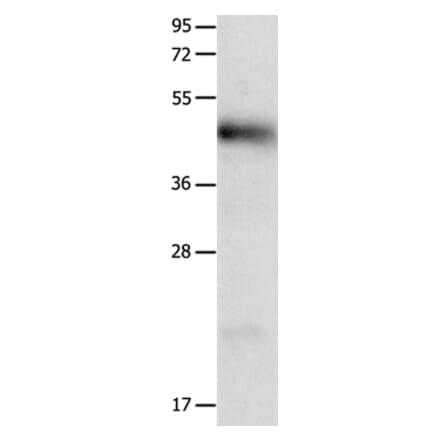 LRP1 Antibody from Signalway Antibody (36956) - Antibodies.com