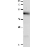 LRP1 Antibody from Signalway Antibody (36956) - Antibodies.com