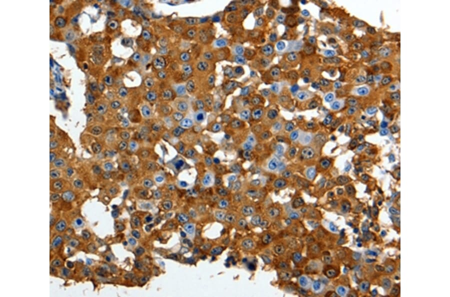 Immunohistochemistry - LRP1 Antibody from Signalway Antibody (36956) - Antibodies.com