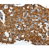 Immunohistochemistry - LRP1 Antibody from Signalway Antibody (36956) - Antibodies.com