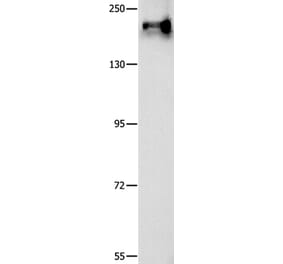 ABCC1 Antibody from Signalway Antibody (36981) - Antibodies.com