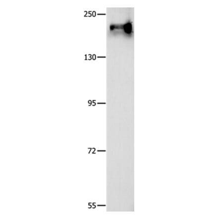 ABCC1 Antibody from Signalway Antibody (36981) - Antibodies.com