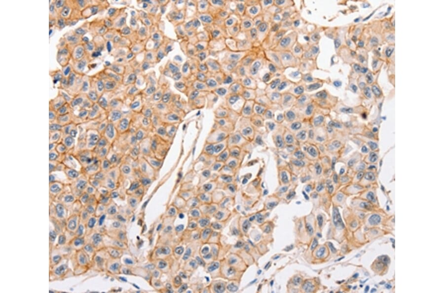 Immunohistochemistry - ABCC1 Antibody from Signalway Antibody (36981) - Antibodies.com