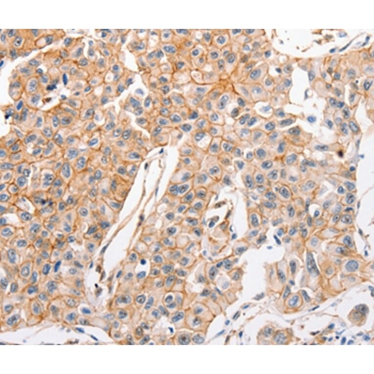 Immunohistochemistry - ABCC1 Antibody from Signalway Antibody (36981) - Antibodies.com