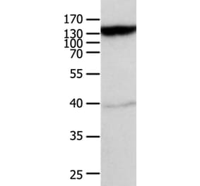 ABCC5 Antibody from Signalway Antibody (36983) - Antibodies.com