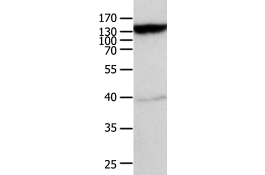 ABCC5 Antibody from Signalway Antibody (36983) - Antibodies.com