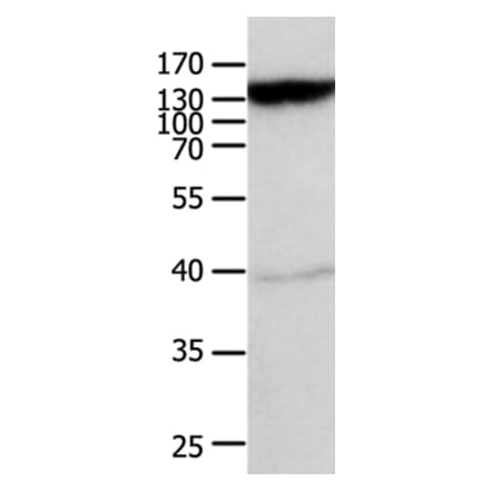 ABCC5 Antibody from Signalway Antibody (36983) - Antibodies.com