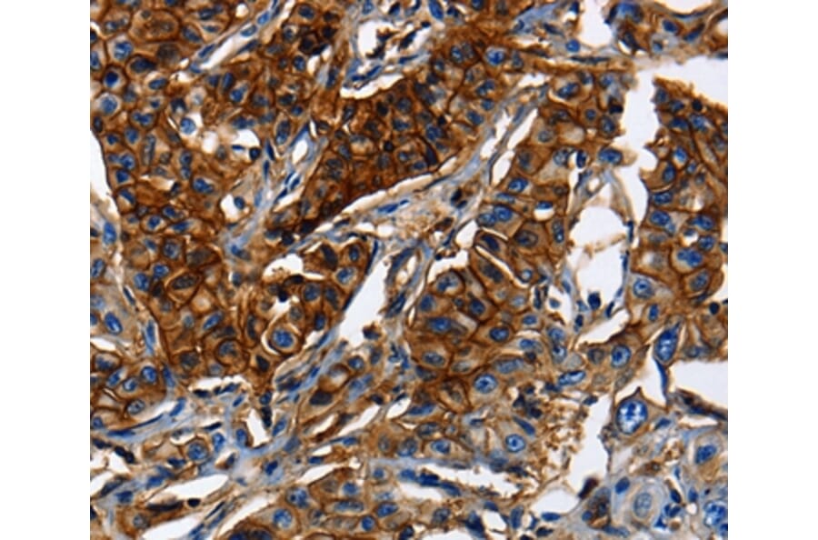 Immunohistochemistry - ABCC5 Antibody from Signalway Antibody (36983) - Antibodies.com