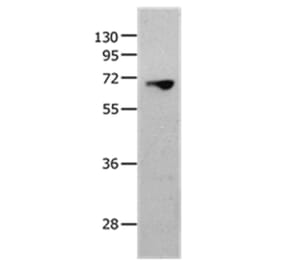 MMP25 Antibody from Signalway Antibody (36986) - Antibodies.com