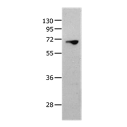 MMP25 Antibody from Signalway Antibody (36986) - Antibodies.com
