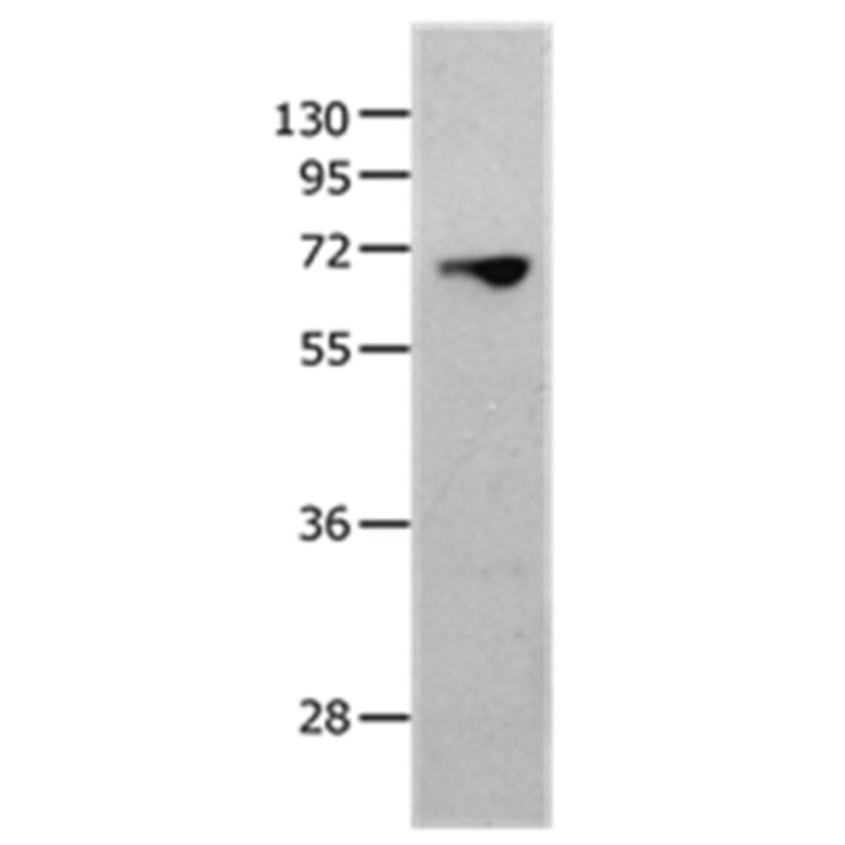 MMP25 Antibody from Signalway Antibody (36986) - Antibodies.com