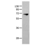 MMP25 Antibody from Signalway Antibody (36986) - Antibodies.com