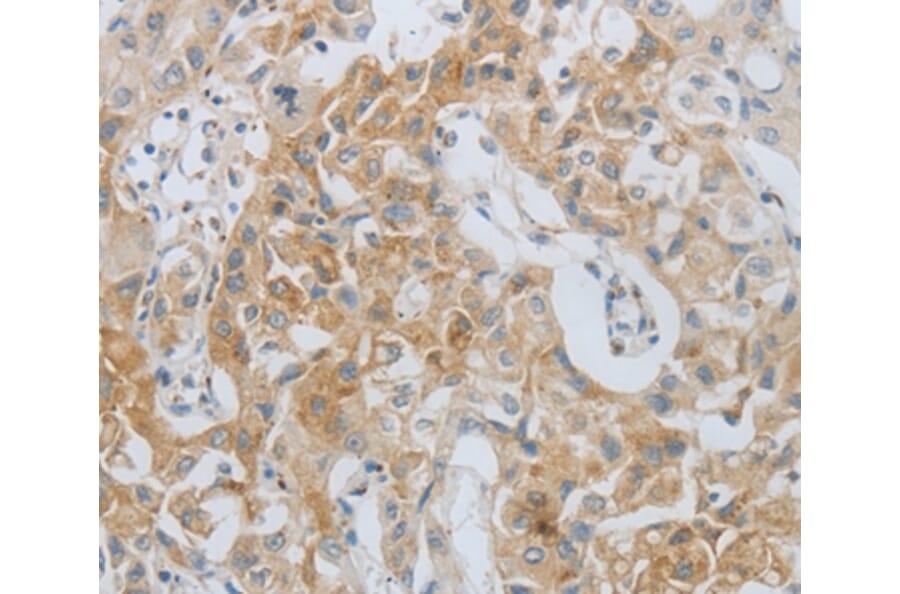 Immunohistochemistry - MMP25 Antibody from Signalway Antibody (36986) - Antibodies.com