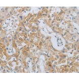 Immunohistochemistry - MMP25 Antibody from Signalway Antibody (36986) - Antibodies.com