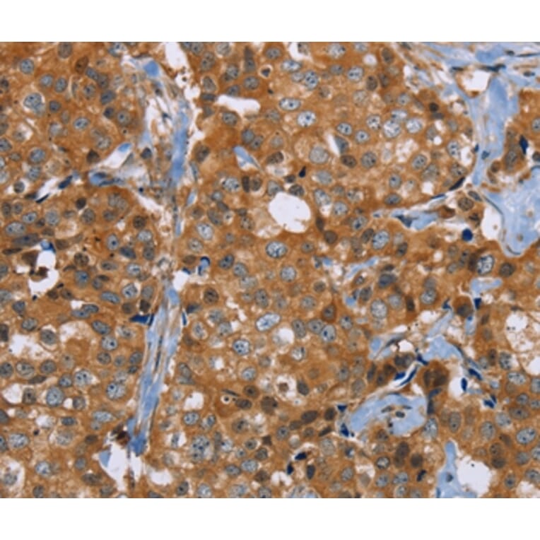 Immunohistochemistry - P2RY1 Antibody from Signalway Antibody (37007) - Antibodies.com