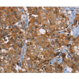 Immunohistochemistry - P2RY1 Antibody from Signalway Antibody (37007) - Antibodies.com