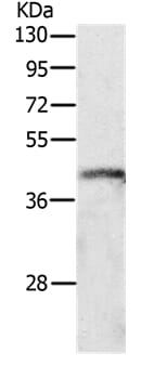 Gel: 10% SDS-PAGE Lysate: 40ug K562 cell Primary antibody: 1/500 dilution Secondary antibody dilution: 1/8000 Exposure time: 1 minute