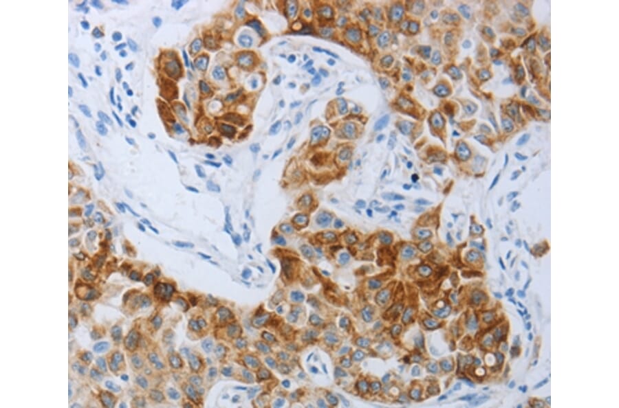 Immunohistochemistry - P2RY4 Antibody from Signalway Antibody (37008) - Antibodies.com