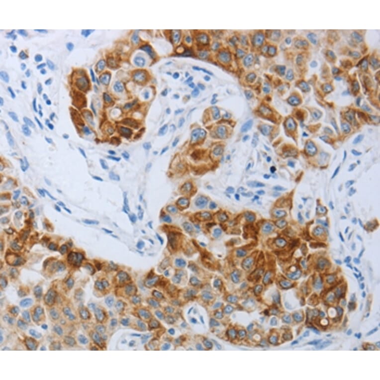 Immunohistochemistry - P2RY4 Antibody from Signalway Antibody (37008) - Antibodies.com