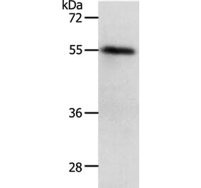 RAD52 Antibody from Signalway Antibody (37023) - Antibodies.com