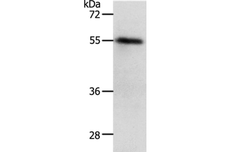 RAD52 Antibody from Signalway Antibody (37023) - Antibodies.com