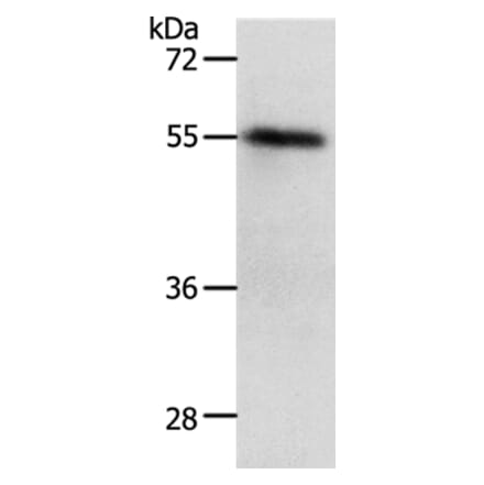 RAD52 Antibody from Signalway Antibody (37023) - Antibodies.com