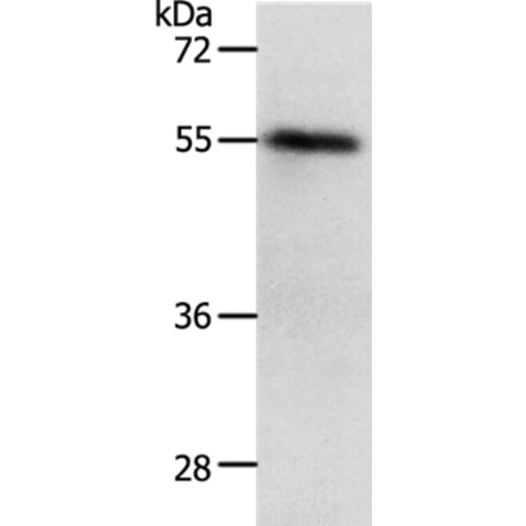 RAD52 Antibody from Signalway Antibody (37023) - Antibodies.com
