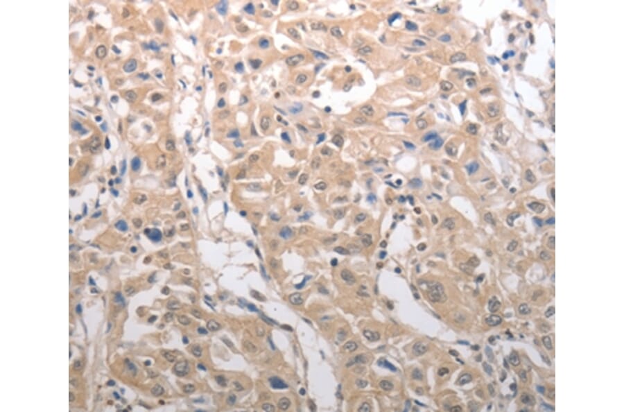 Immunohistochemistry - RAD52 Antibody from Signalway Antibody (37023) - Antibodies.com