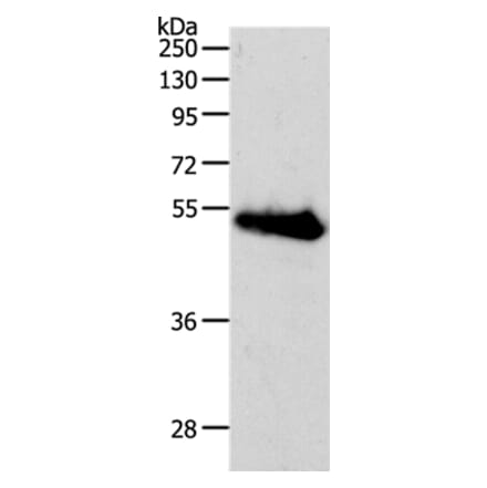 RBMS3 Antibody from Signalway Antibody (37025) - Antibodies.com
