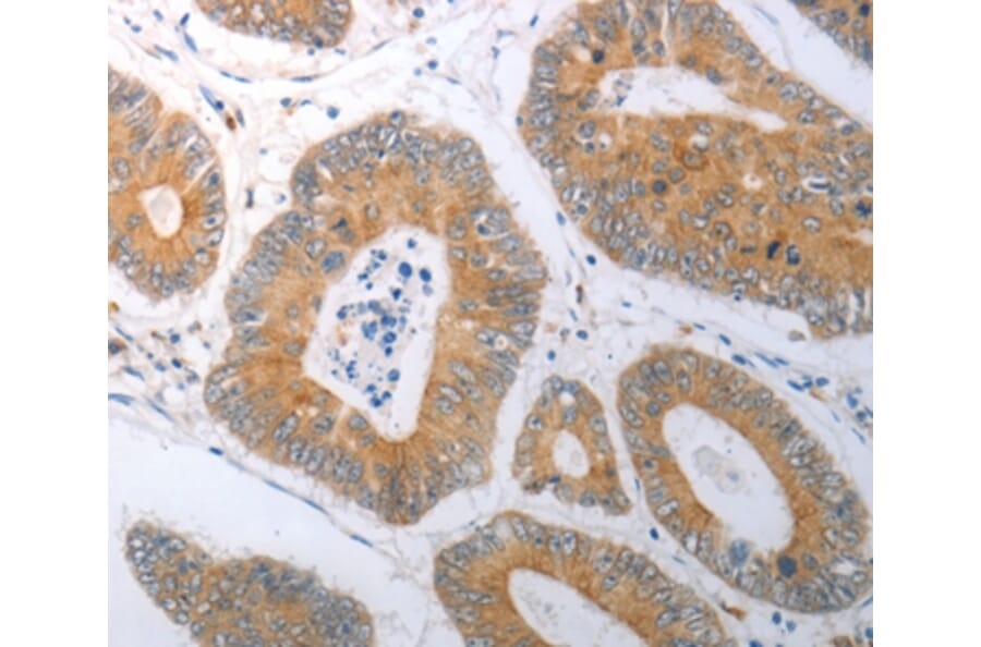 Immunohistochemistry - RBMS3 Antibody from Signalway Antibody (37025) - Antibodies.com