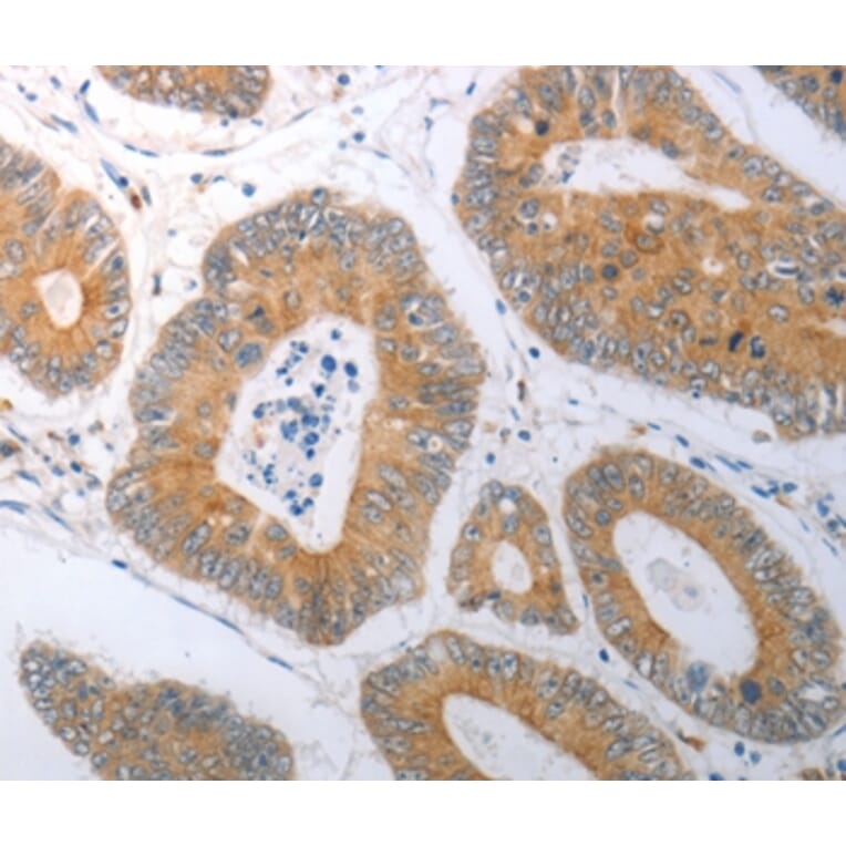 Immunohistochemistry - RBMS3 Antibody from Signalway Antibody (37025) - Antibodies.com