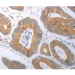 Immunohistochemistry - RBMS3 Antibody from Signalway Antibody (37025) - Antibodies.com