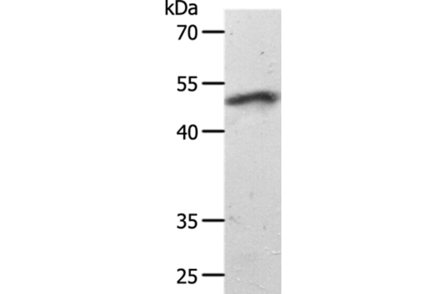 SMAD7 Antibody from Signalway Antibody (37036) - Antibodies.com