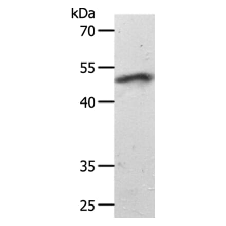 SMAD7 Antibody from Signalway Antibody (37036) - Antibodies.com
