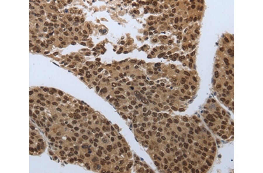 Immunohistochemistry - SMAD7 Antibody from Signalway Antibody (37036) - Antibodies.com