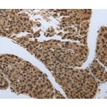 Immunohistochemistry - SMAD7 Antibody from Signalway Antibody (37036) - Antibodies.com