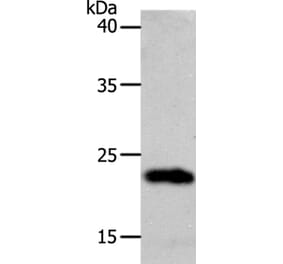 SOCS1 Antibody from Signalway Antibody (37038) - Antibodies.com