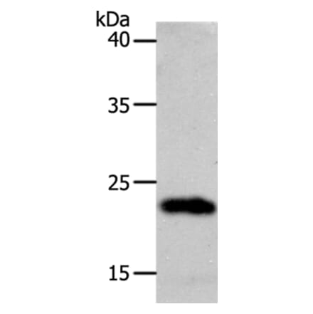 SOCS1 Antibody from Signalway Antibody (37038) - Antibodies.com