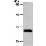 SOCS1 Antibody from Signalway Antibody (37038) - Antibodies.com