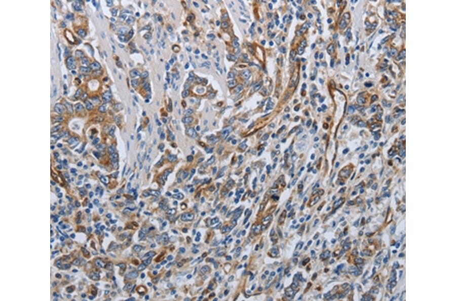 Immunohistochemistry - SOCS1 Antibody from Signalway Antibody (37038) - Antibodies.com